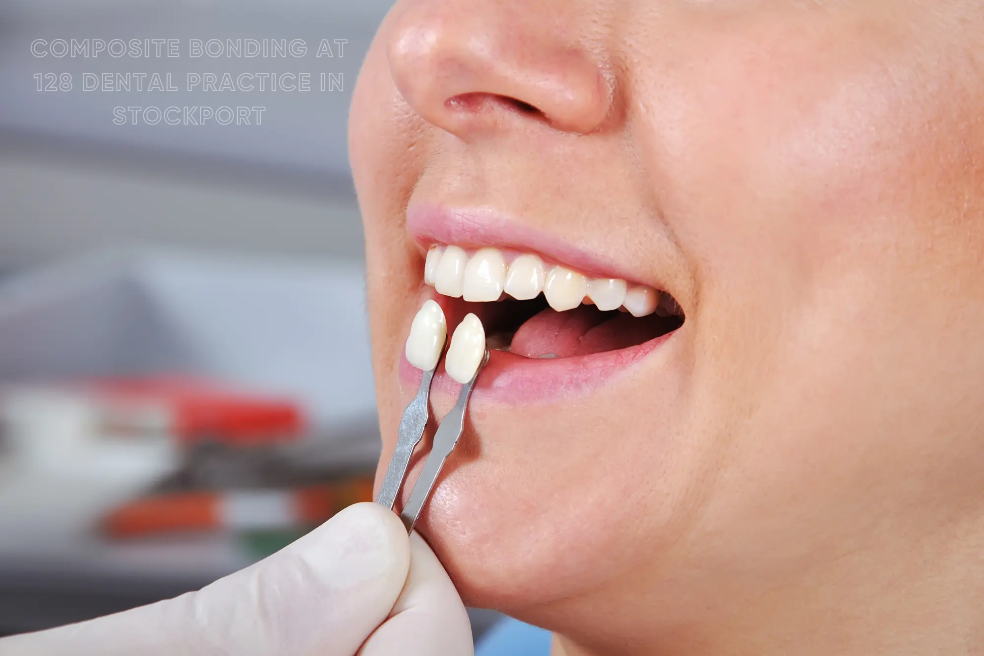 Composite bonding at 128 dental practice in Stockport