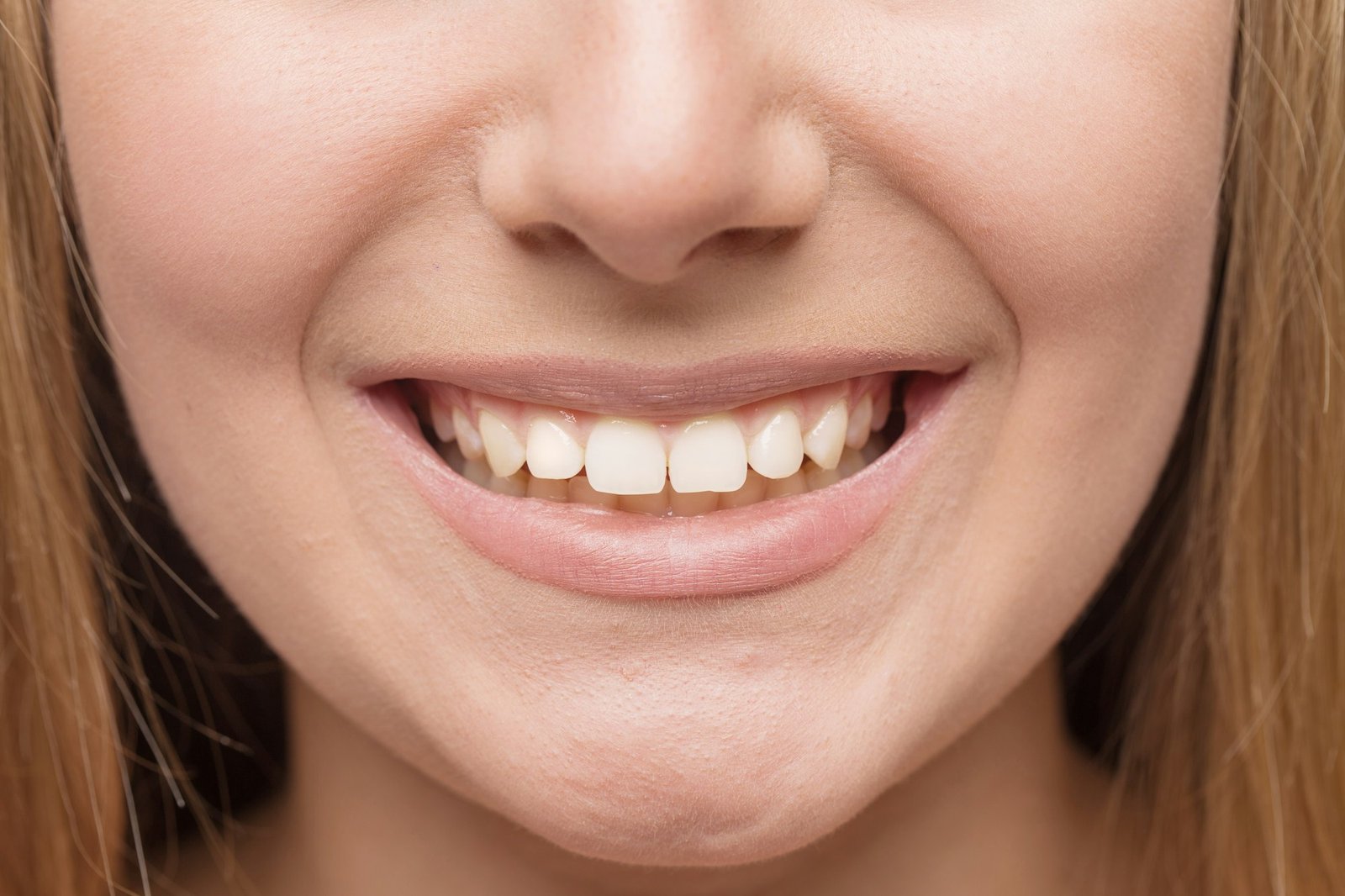 Smile with white healthy teeth.