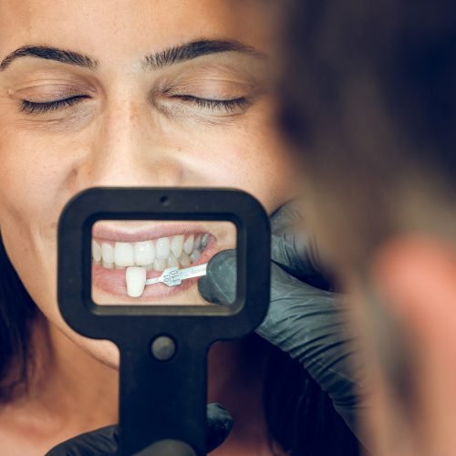 Dentist picking sample of teeth veneer for woman